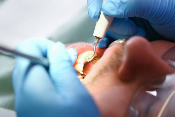 Best Emergency Treatment for Toothache in Norwood, NJ