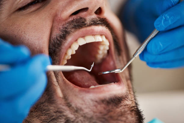 Best Walk-In Emergency Dentist in Norwood, NJ